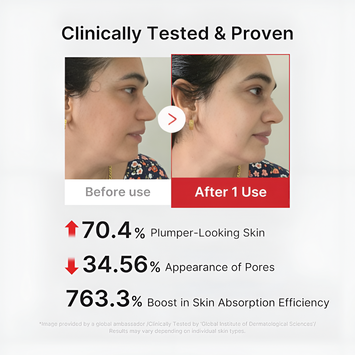 Vitalyn Age-R Booster Pro | Beauty Massager